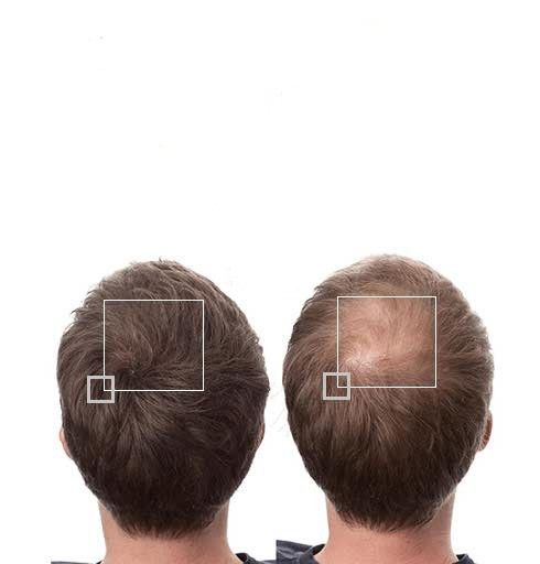 6a1813f3730f8d11887de7afe81308cd