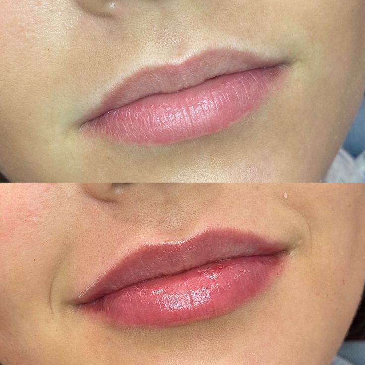 Élan signature lips