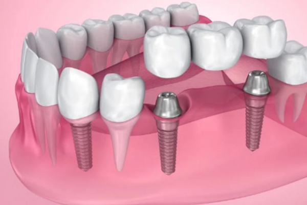 untitled design (29)