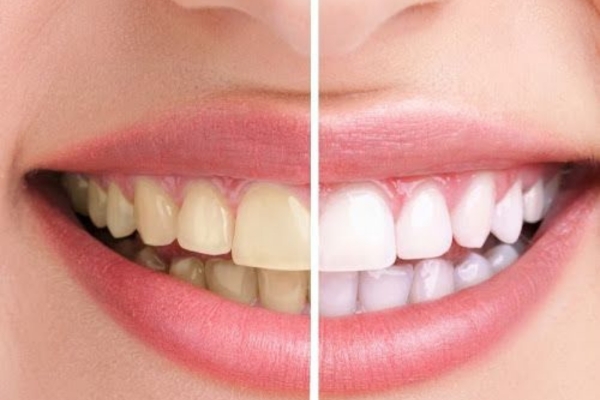 untitled design (35)