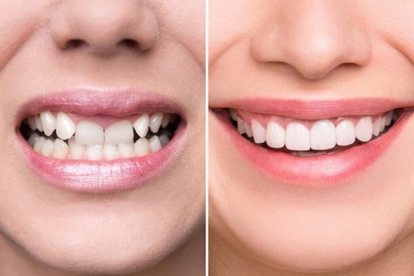 untitled design (36)